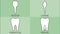 Tooth type with detail word - incisor, canine, premolar, molar, kind of teeth