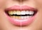 tooth whitening dentist pictures