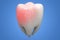 Toothache concept, human tooth with caries isolated on blue background. 3D rendering