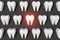 Toothache problem 3d rendering pattern grey background. White healthy teeth molar tooth with pain National Dentist\\\'s Day