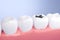 Toothache and teeth decay with healthy tooth