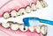 Toothbrush cleaning wooden dentures with caries and cavities on white background with copy space.  Dental Health care