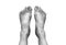 Top view picture of two bare human female feet with a wounded big toe healed with bandage for medical care. Black and white tone