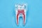 Top view of silicone tooth model with red dental root isolated on blue.