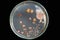 Top view soil microorganisms Nutrient agar in plate on black background