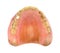 Top view worn denture teeth
