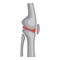 Total knee replacement surgery icon, cartoon style