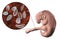 Transmission of Toxoplasma gondii parasites to fetus, medical concept