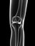 Transparent female skeleton - knee joint