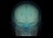 transparent image of the Skull with Brain .