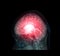 Transparent image of the Skull  with  Brain for medical background concept