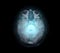 Transparent image of the Skull  with  Brain for medical background concept