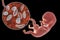 Transplacental transmission of Toxoplasma gondii parasites to human embryo