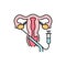 Transvaginal oocyte retrieval olor line icon. Pregnancy. Pictogram for web page, mobile app, promo.