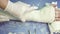 Traumatologist puts plaster bandage on sick arm in department of traumatology.