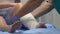 Traumatologist wearing elastic bandage on injured patient leg, trauma result