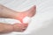 Treatment of heel spurs using physiotherapy, medical magnet, technology, close-up, copy space, white background