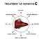 Treatment of hepatitis C. World Hepatitis Day. Infographics. Vector illustration on isolated background.