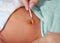 Treatment of newborn baby navel with a cotton swab