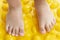 Treatment and prevention of flat feet in children. A small child walks barefoot on an orthopedic mat puzzle.