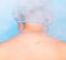Treatment of scars on the skin of a person using the modern method of cryotherapy, treatment with liquid nitrogen and