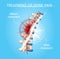 Treatment of Spine Pain Realistic Vector Chart