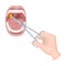 Treatment of the tonsils In the oral cavity. Medicine single icon in cartoon style vector symbol stock illustration web.