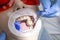 Treatment of tooth decay. girl at  reception at the dentist. the doctor drilled a tooth boron machine removed caries. the tooth is