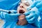 Treatment of tooth loss. Modern dental technologies
