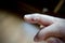 Treatment wart on finger by salicylic acid