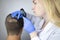 A trichologist examines the hair of a man who begins alopecia. Consultation with a dermatologist. Hair loss, alopecia, pruritus,