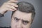 A trichologist examines a young manâ€™s gray hair under a magnifying glass. Earlier bleaching of hair and pigment as a sign of low