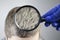 A trichologist examines a young manâ€™s gray hair under a magnifying glass. Earlier bleaching of hair and pigment as a sign of low