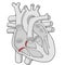Tricuspid velve - Heart - Human body - Education