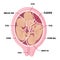 triplets in uterus. three fetuses in the womb. Multiple pregnancy. risk factor. Three umbilical cords.