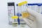 Tube of urine test tube in hand, Health-care And Medicine. Medical urine test, close-up,