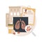 Tuberculosis abstract concept vector illustration.