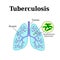 Tuberculosis. Lung disease. Tubercle bacillus. Vector illustration