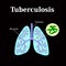 Tuberculosis. Lung disease. Tubercle bacillus. Vector illustration on a black background