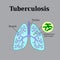 Tuberculosis. Lung disease. Tubercle bacillus. Vector illustration on a gray background
