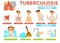 Tuberculosis symptoms and measures infographics information for patients