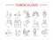 Tuberculosis Symptoms, Treatment. Line icons set. Vector signs for web graphics.