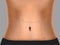 Tummy Marked Dotted Line For Plastic Surgery