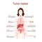 Tumor marker or biomarker. silhouette of a woman with internal o