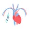 Tunneled central line venous catheter medical diagram