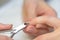 Tweezers being used on woman`s fingernail