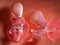 Twin fetuses - week 15