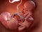 Twin fetuses - week 20