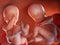 Twin fetuses - week 24