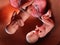 Twin fetuses - week 40